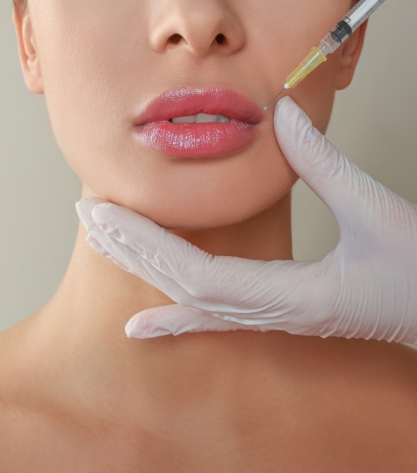 Juvederm Dermal Filler